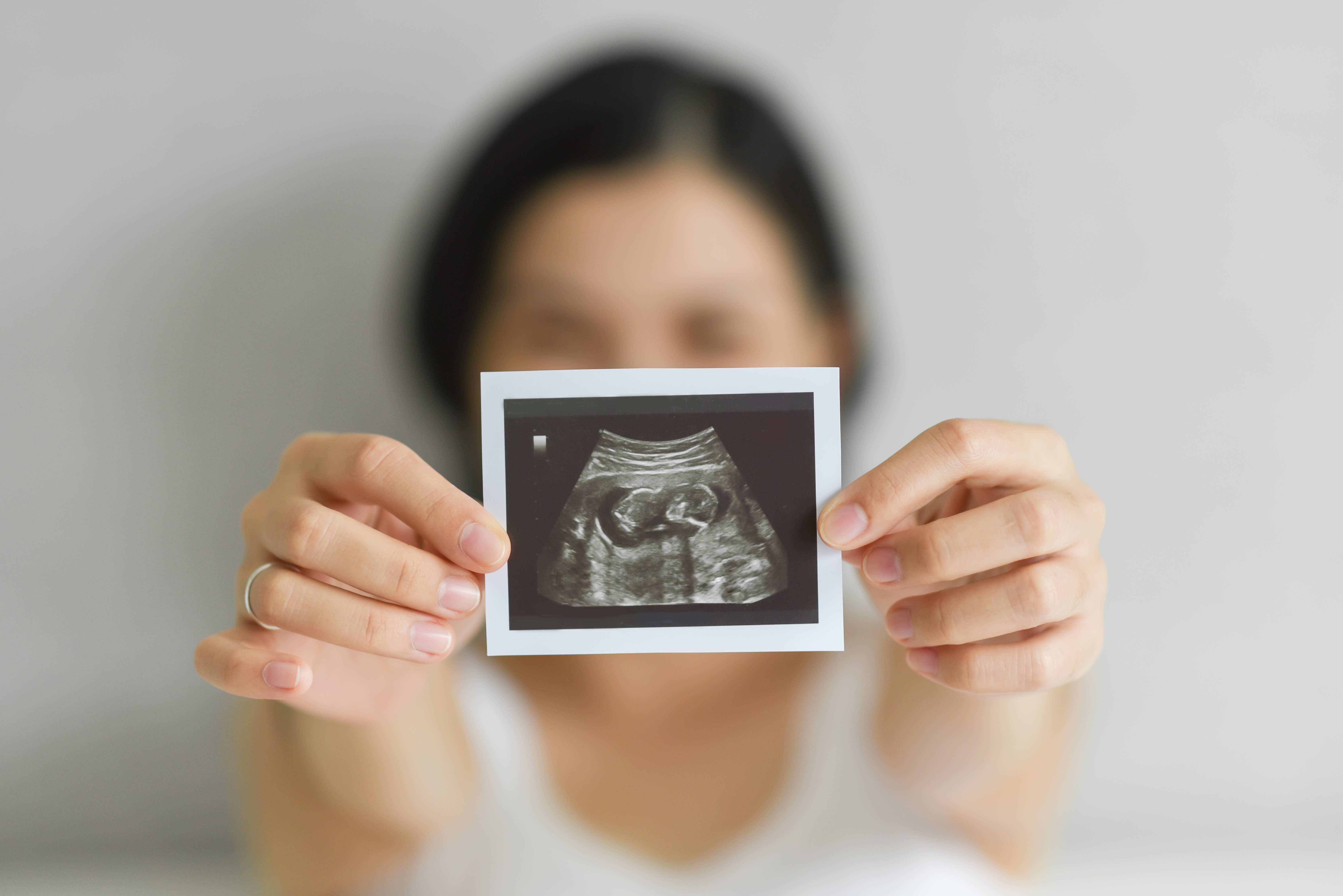 Happy,Young,Pregnant,Woman,Holding,Showing,Ultrasound,Scan,Photo.,Smiling